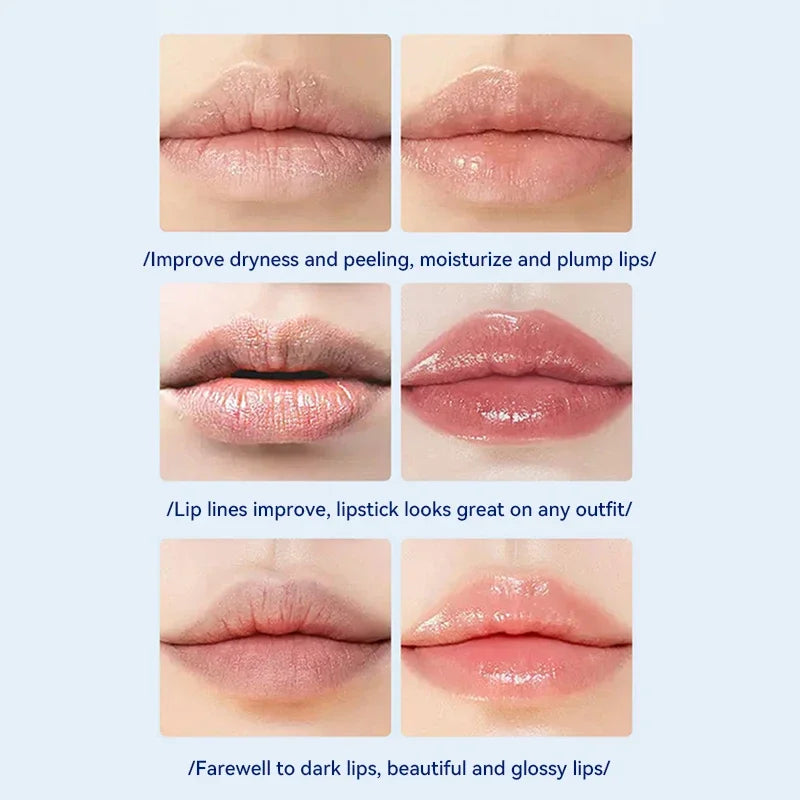 Hyaluronic Acid Lip Lightening & Moisturizing Balm